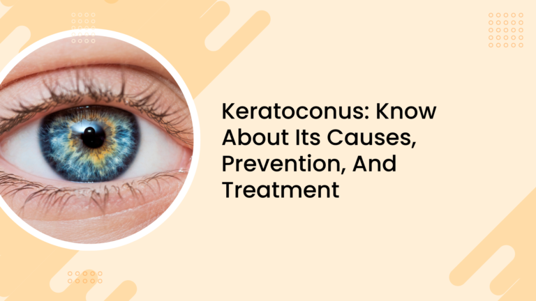 Keratoconus: Know About Its Causes, Prevention, And Treatment