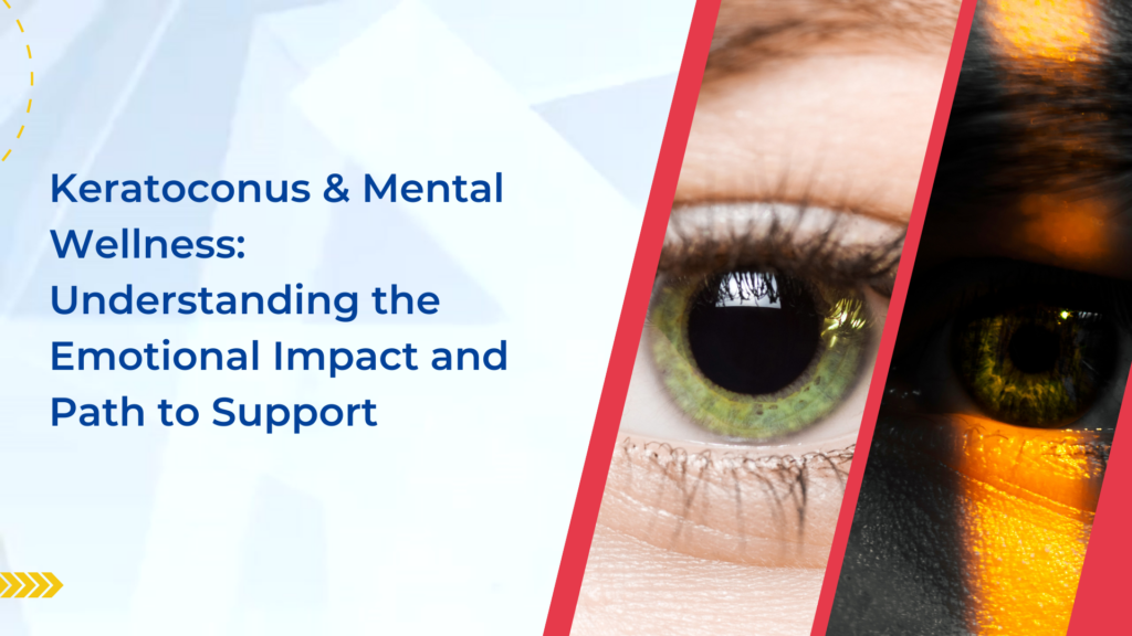 Keratoconus & Mental Wellness: Understanding the Emotional Impact and Path to Support