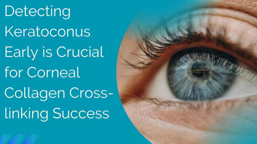 Detecting Keratoconus Early is Crucial for Corneal Collagen Cross-linking Success