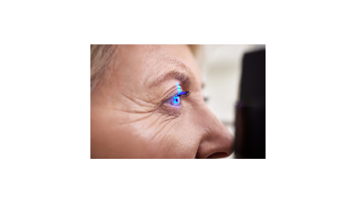 How Corneal Collagen Cross-linking Works