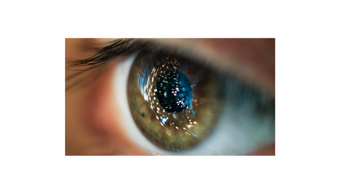 What is Keratoconus