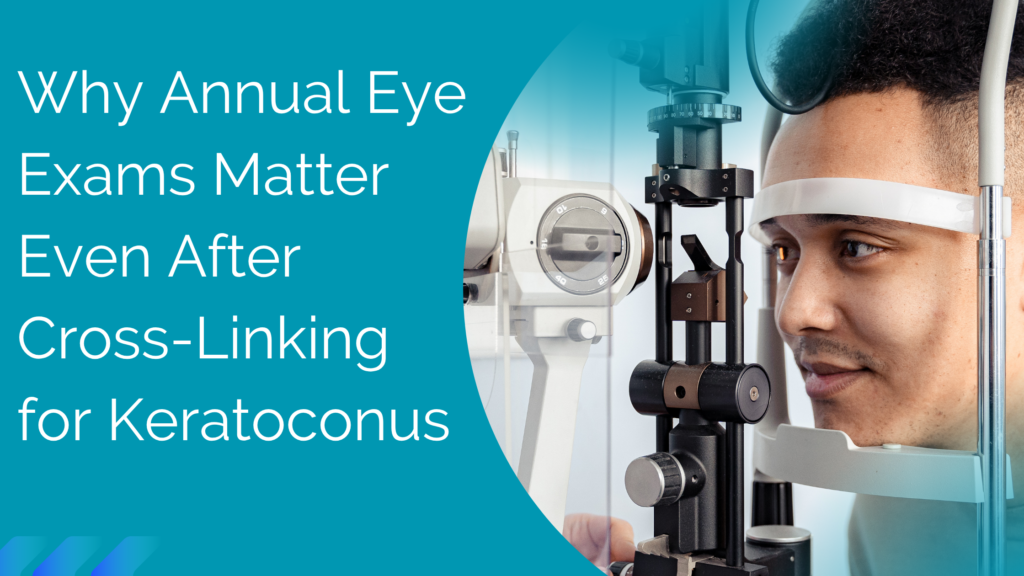 Why Annual Eye Exams Matter Even After Cross-Linking for Keratoconus