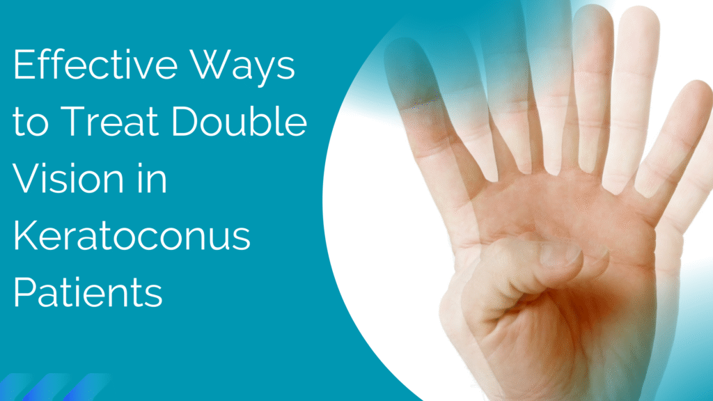 Effective Ways to Treat Double Vision in Keratoconus Patients