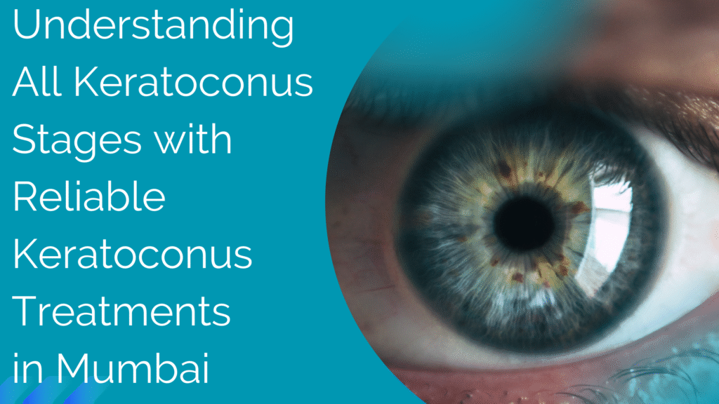 Understanding All Keratoconus Stages with Reliable Keratoconus Treatments in Mumbai