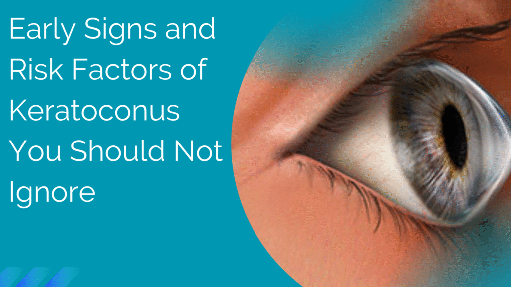 Early Signs and Risk Factors of Keratoconus You Should Not Ignore