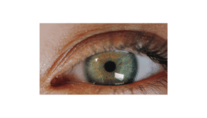 Corneal Collagen Cross-Linking (C3R)