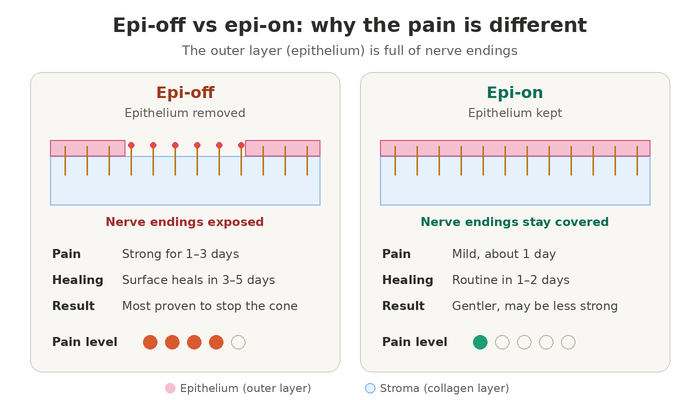 Epi-off vs epi-on cross-linking compared for pain, healing time and results after C3R