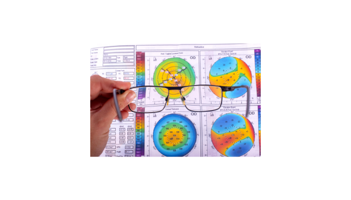 The Importance of Specialized Keratoconus Care