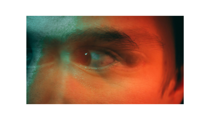 Understanding Double Vision in Keratoconus