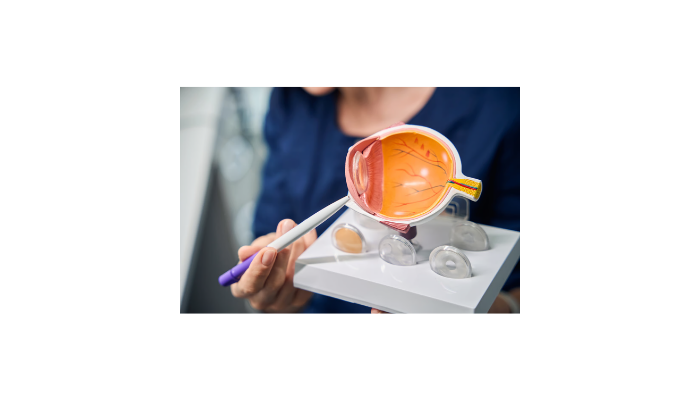 Understanding ICL Treatment